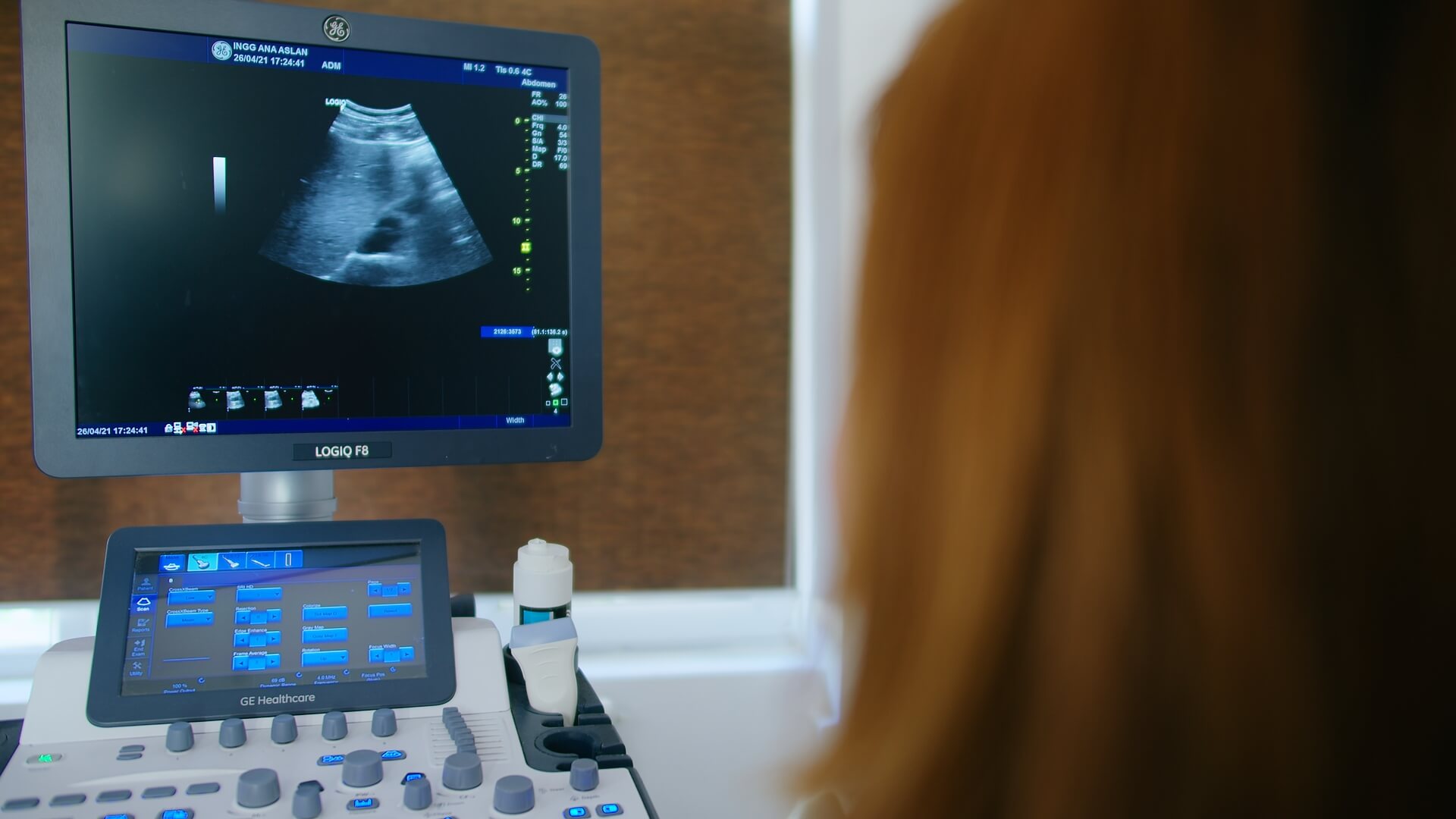 foto-investigatii-ecografice-3